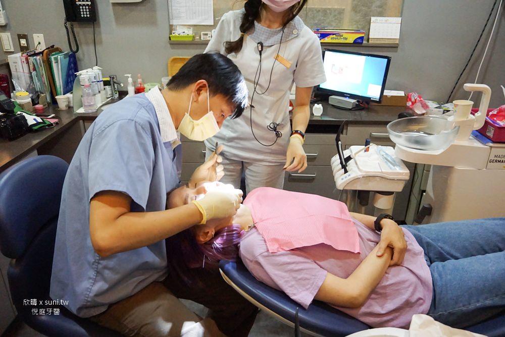 台北牙醫診所推薦悅庭一日全瓷冠/美白牙齒瓷牙貼片/植牙｜專屬微笑曲線不是夢~原來牙技師來是這樣做出牙齒