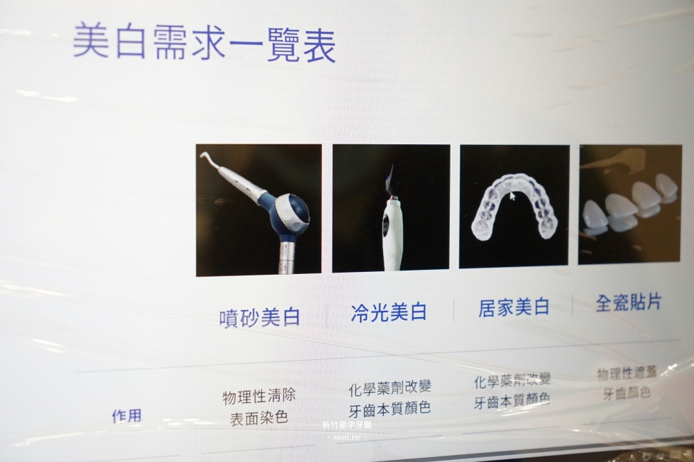 新竹牙齒美白推薦｜星宇牙醫診所。全新開幕最美診間、一次美白7階的「噴砂美白」和「冷光美白」