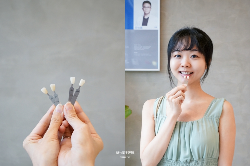 新竹牙齒美白推薦｜星宇牙醫診所。全新開幕最美診間、一次美白7階的「噴砂美白」和「冷光美白」